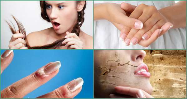 Нарушение здоровья кожи, ногтей и волос