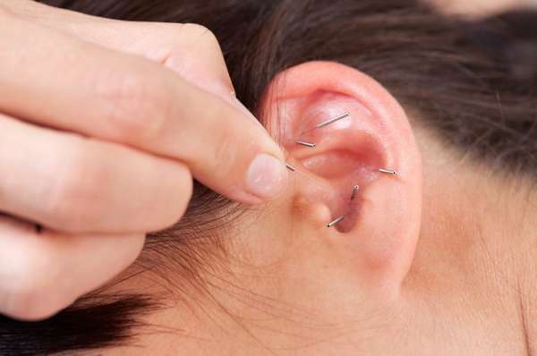 Серебряная иголка для похудения в ухо