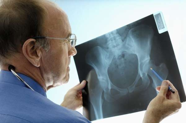 Рентгенологическое исследование тазобедренного сустава